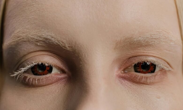 impact vision for business scaling